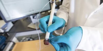 Demonstração de uso da caneta MasSpec em uma amostra de tecido humano — Foto: Vivian Abagiu/Universidade do Texas