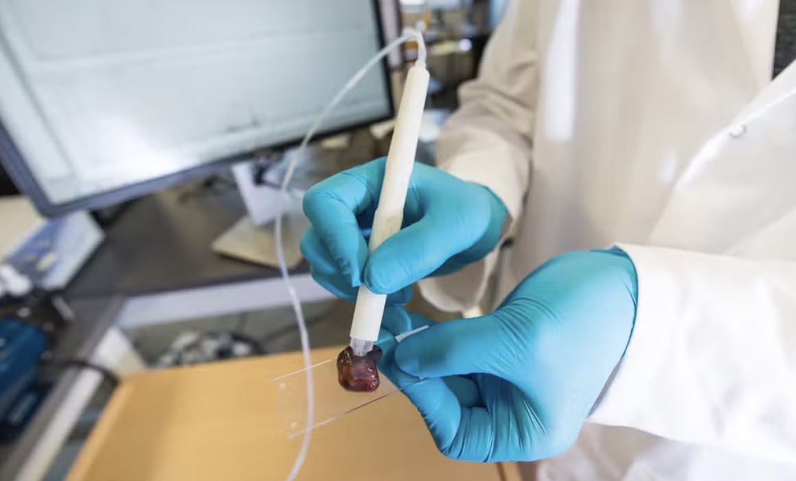 Demonstração de uso da caneta MasSpec em uma amostra de tecido humano — Foto: Vivian Abagiu/Universidade do Texas