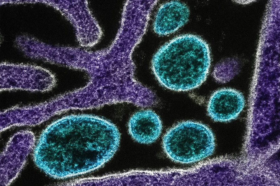 IMG_9089 - Diario do Povo Vírus Nipah Imagem: National Institute of Allergy and Infectious Diseases/Unsplash