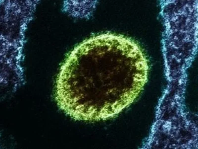 Vírus Nipah